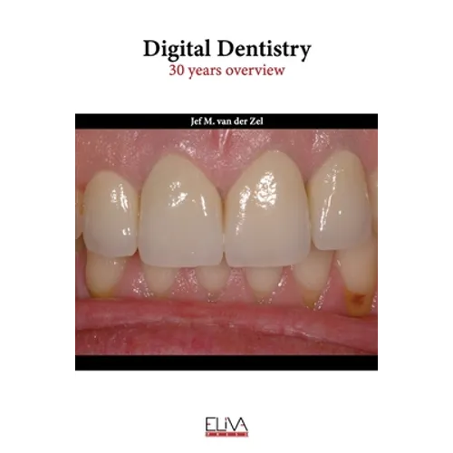 Digital Dentistry: 30 years overview
