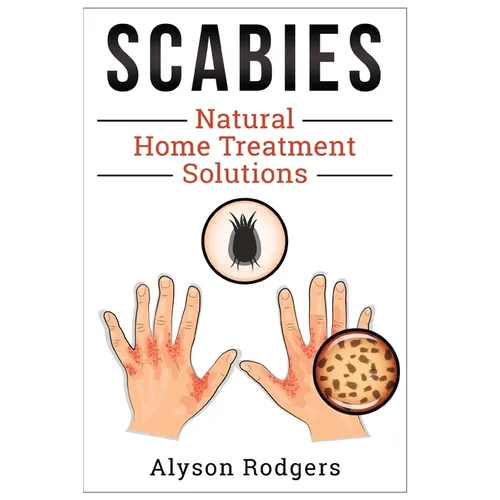 Scabies Natural Home Treatment Solution