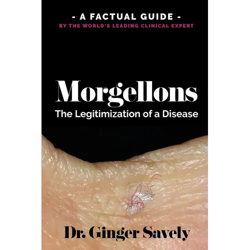 Morgellons: The legitimization of a disease: A Factual Guide by the World's Leading Clinical Expert