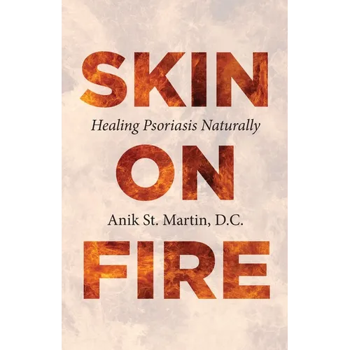 Skin on Fire: Healing Psoriasis Naturally