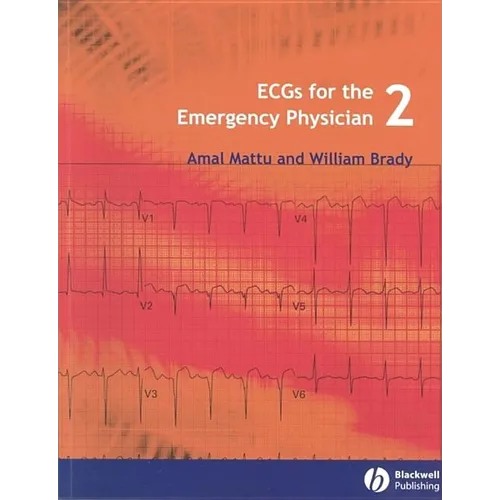 Ecgs for the Emergency Physician 2
