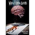 When a Brain Bleeds