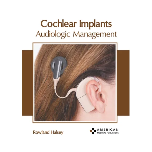 Cochlear Implants: Audiologic Management