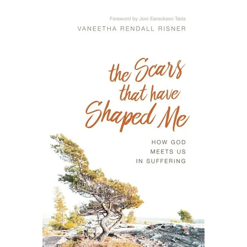 The Scars That Have Shaped Me: How God Meets Us in Suffering