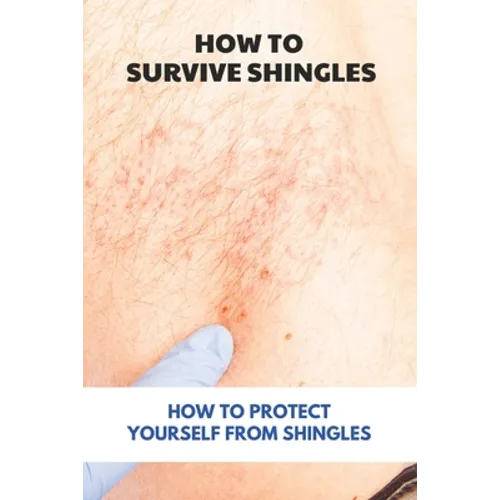 How To Survive Shingles: How To Protect Yourself From Shingles: How To Speed Up Shingles Recovery