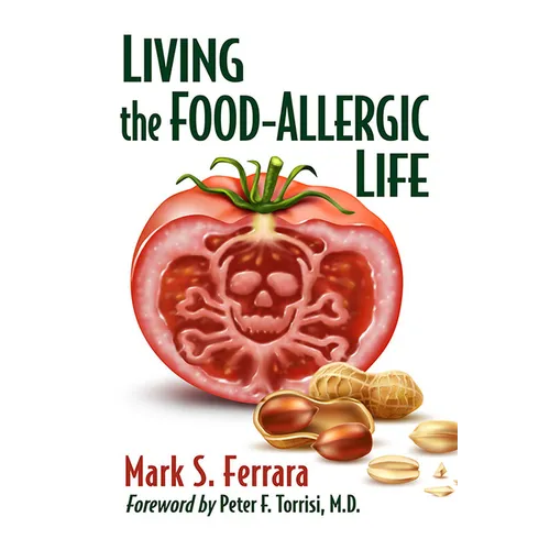 Living the Food-Allergic Life
