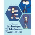 An Illustrated Technique for Dilation and Evacuation