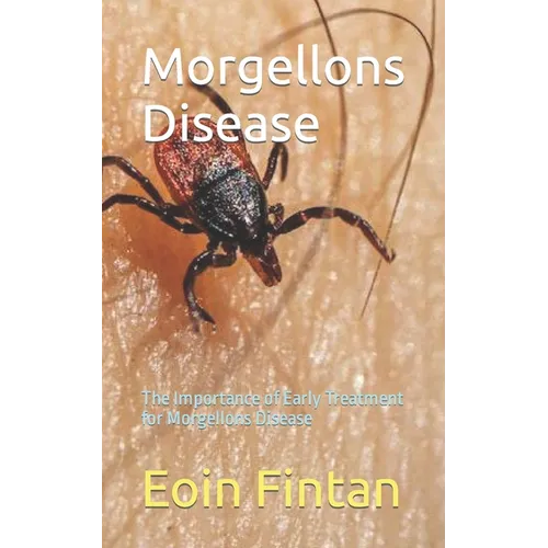 Morgellons Disease: The Importance of Early Treatment for Morgellons Disease