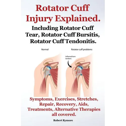 Rotator Cuff Injury Explained. Including Rotator Cuff Tear, Rotator Cuff Bursitis, Rotator Cuff Tendonitis. Symptoms, Exercises, Stretches, Repair, Re