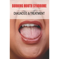Burning Mouth Syndrome: Diagnosis & Treatment: Burning Mouth Syndrome Guide