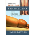 It's Not Just a Swelling! Lymphedema: Causes, Prevention, Treatment, Self-Management