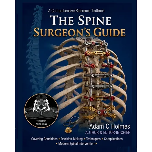 The Spine Surgeon's Guide: A Comprehensive Reference Textbook Covering Spine Conditions, Surgical Decision- Making, Operative Techniques, Complication