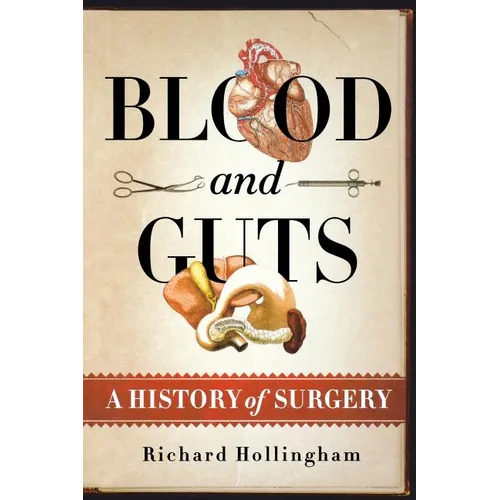 Blood and Guts: A History of Surgery