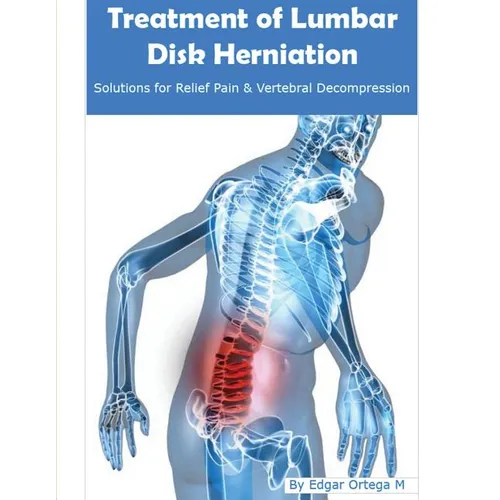 Treatment of Lumbar Disk Herniation: Back Pain Relief and Herniated Discs Solutions