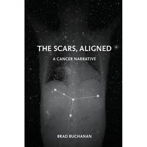 The Scars, Aligned