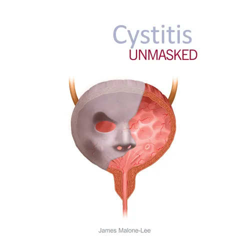 Cystitis Unmasked