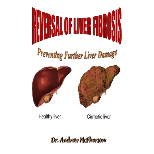Reversal of Liver Fibrosis: Preventing Further Liver Damage