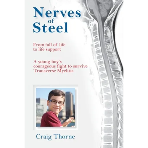 Nerves of Steel