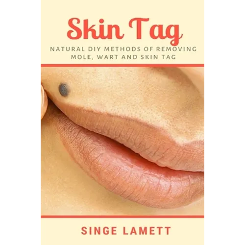 Skin Tag: Natural DIY Methods of removing Mole, Wart and Skin Tag